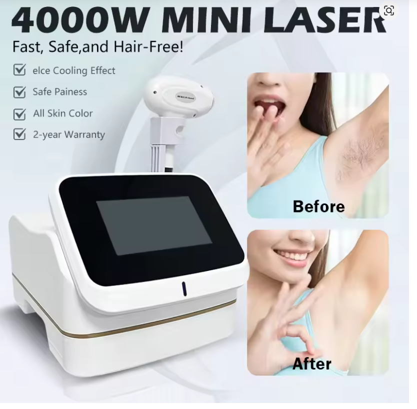 Máquina de depilación láser de - Industrial Laser Hair Removal Machine reseña y precio
