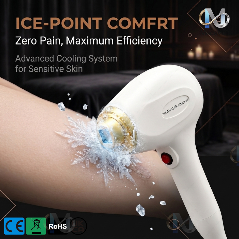 Nueva Máquina de Belleza Sopra - Industrial Laser Hair Removal Machine reseña y precio